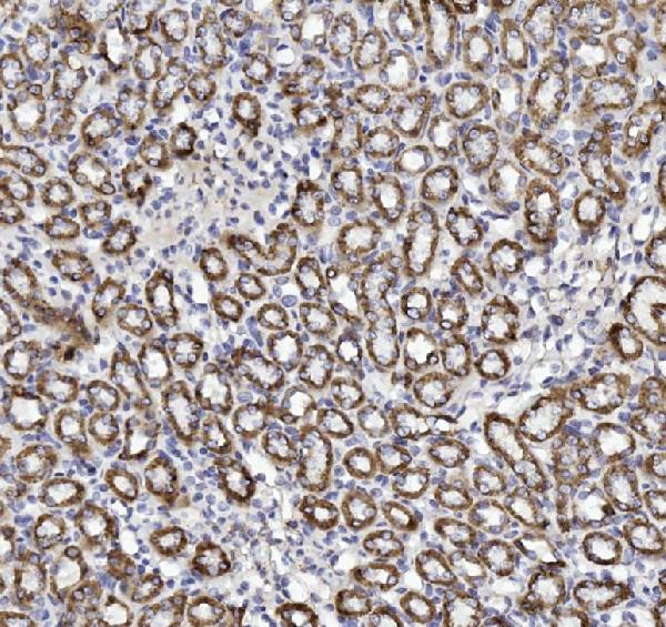 IHC analysis of Cytochrome C using anti-Cytochrome C antibody (PA1118). Cytochrome C was detected in paraffin-embedded section of rat kidney tissues. Heat mediated antigen retrieval was performed in citrate buffer (pH6, epitope retrieval solution) for 20 mins. The tissue section was blocked with 10% goat serum. The tissue section was then incubated with 1μg/ml rabbit anti-Cytochrome C Antibody (PA1118) overnight at 4°C. Biotinylated goat anti-rabbit IgG was used as secondary antibody and incubated for 30 minutes at 37°C. The tissue section was developed using Strepavidin-Biotin-Complex (SABC)(Catalog # SA1022) with DAB as the chromogen.