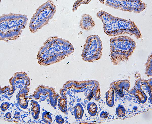 IHC analysis of FAS using anti-FAS antibody (PA1119). FAS was detected in paraffin-embedded section of mouse intestine tissue. Heat mediated antigen retrieval was performed in citrate buffer (pH6, epitope retrieval solution) for 20 mins. The tissue section was blocked with 10% goat serum. The tissue section was then incubated with 1μg/ml rabbit anti-FAS Antibody (PA1119) overnight at 4°C. Biotinylated goat anti-rabbit IgG was used as secondary antibody and incubated for 30 minutes at 37°C. The tissue section was developed using Strepavidin-Biotin-Complex (SABC)(Catalog # SA1022) with DAB as the chromogen.