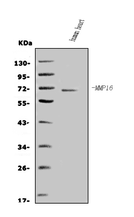 Western blot analysis of MMP16 using anti-MMP16 antibody (PA1123).