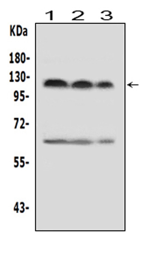 Western blot analysis of HIF-2A using anti-HIF-2A antibody (PA1129-2). Electrophoresis was performed on a 5-20% SDS-PAGE gel at 70V (Stacking gel) / 90V (Resolving gel) for 2-3 hours. The sample well of each lane was loaded with 50ug of sample under reducing conditions. Lane 1: human MCF-7 whole cell lysates, Lane 2: human Hela whole cell lysates, Lane 3: human Jurkat whole cell lysates, After Electrophoresis, proteins were transferred to a Nitrocellulose membrane at 150mA for 50-90 minutes. Blocked the membrane with 5% Non-fat Milk/ TBS for 1.5 hour at RT. The membrane was incubated with rabbit anti-HIF-2A antigen affinity purified polyclonal antibody (Catalog # PA1129-2) at 0.5 μg/mL overnight at 4°C, then washed with TBS-0.1%Tween 3 times with 5 minutes each and probed with a goat anti-rabbit IgG-HRP secondary antibody at a dilution of 1:10000 for 1.5 hour at RT. The signal is developed using an Enhanced Chemiluminescent detection (ECL) kit (Catalog # EK1002) with Tanon 5200 system. A specific band was detected for HIF-2A at approximately 120KD. The expected band size for HIF-2A is at 96KD.