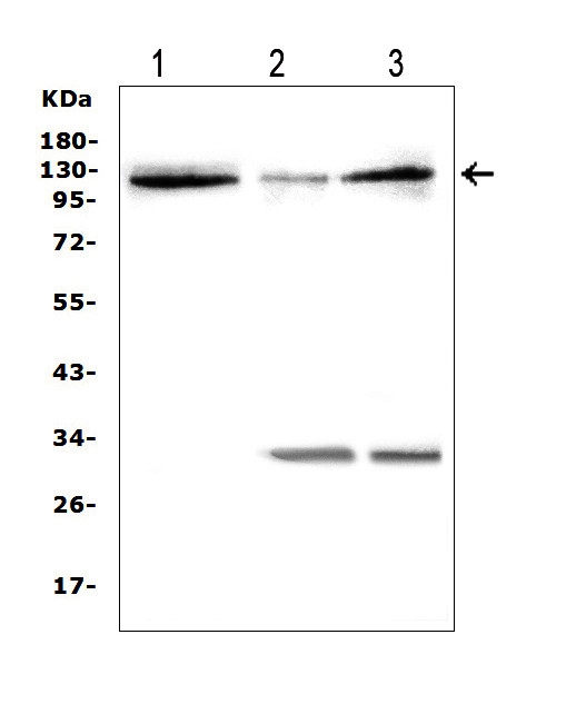 Western blot analysis of HIF-2A using anti-HIF-2A antibody (PA1129-2). Electrophoresis was performed on a 5-20% SDS-PAGE gel at 70V (Stacking gel) / 90V (Resolving gel) for 2-3 hours. The sample well of each lane was loaded with 50ug of sample under reducing conditions. Lane 1: rat brain tissue lysates, Lane 2: rat RH35 whole cell lysates, Lane 3: rat small intestine tissue lysates, After Electrophoresis, proteins were transferred to a Nitrocellulose membrane at 150mA for 50-90 minutes. Blocked the membrane with 5% Non-fat Milk/ TBS for 1.5 hour at RT. The membrane was incubated with rabbit anti-HIF-2A antigen affinity purified polyclonal antibody (Catalog # PA1129-2) at 0.5 μg/mL overnight at 4°C, then washed with TBS-0.1%Tween 3 times with 5 minutes each and probed with a goat anti-rabbit IgG-HRP secondary antibody at a dilution of 1:10000 for 1.5 hour at RT. The signal is developed using an Enhanced Chemiluminescent detection (ECL) kit (Catalog # EK1002) with Tanon 5200 system. A specific band was detected for HIF-2A at approximately 120KD. The expected band size for HIF-2A is at 96KD.