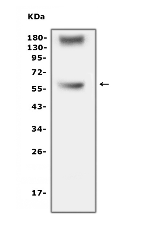 Western blot analysis of TNF Receptor I using anti-TNF Receptor I antibody (PA1210). Electrophoresis was performed on a 5-20% SDS-PAGE gel at 70V (Stacking gel) / 90V (Resolving gel) for 2-3 hours. The sample well of each lane was loaded with 50ug of sample under reducing conditions. Lane 1: human SW579 whole cell lysates. After Electrophoresis, proteins were transferred to a Nitrocellulose membrane at 150mA for 50-90 minutes. Blocked the membrane with 5% Non-fat Milk/ TBS for 1.5 hour at RT. The membrane was incubated with rabbit anti-TNF Receptor I antigen affinity purified polyclonal antibody (Catalog # PA1210) at 0.5 μg/mL overnight at 4°C, then washed with TBS-0.1%Tween 3 times with 5 minutes each and probed with a goat anti-rabbit IgG-HRP secondary antibody at a dilution of 1:10000 for 1.5 hour at RT. The signal is developed using an Enhanced Chemiluminescent detection (ECL) kit (Catalog # EK1002) with Tanon 5200 system. A specific band was detected for TNF Receptor I at approximately 50-60KD. The expected band size for TNF Receptor I is at 50KD.