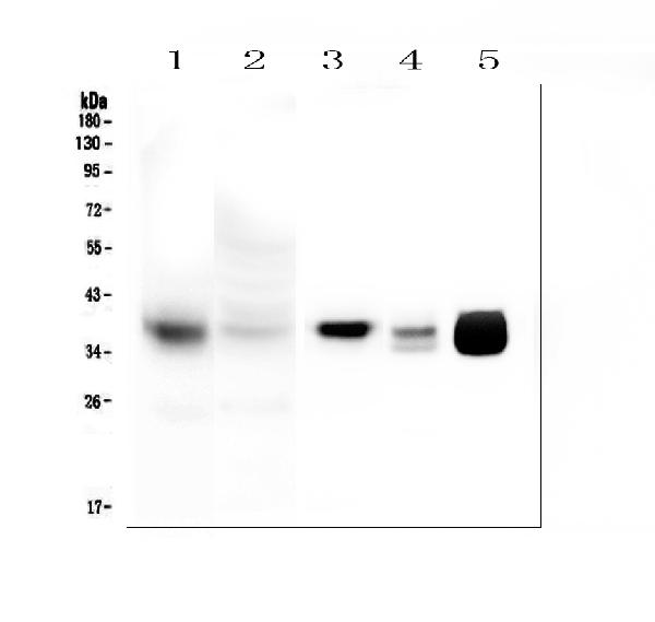 Western blot analysis of MTCO1 using anti-MTCO1 antibody (PA1317-1). Electrophoresis was performed on a 5-20% SDS-PAGE gel at 70V (Stacking gel) / 90V (Resolving gel) for 2-3 hours. The samples were loaded under reducing conditions. Lane 1: human HeLa mitochondria lysates at 20ug, Lane 2: human HeLa whole cell lysates at 20ug, Lane 3: human Caco-2 whole cell lysates at 50ug, Lane 4: rat heart tissue lysates at 50ug. Lane 5: mouse heart tissue lysates at 50ug. After Electrophoresis, proteins were transferred to a Nitrocellulose membrane at 150mA for 60 minutes. Blocked the membrane with 5% Non-fat Milk in TBS for 1.5 hour at RT. The membrane was incubated with rabbit anti-MTCO1 antigen affinity purified polyclonal antibody (Catalog # PA1317-1) at 0.5 μg/mL overnight at 4°C, then washed with TBS-0.1%Tween 3 times with 5 minutes each and probed with a goat anti-rabbit IgG-HRP secondary antibody at a dilution of 1:10000 for 1.5 hour at RT. The signal is developed using an Enhanced Chemiluminescent detection (ECL) kit (Catalog # EK1002) with Tanon 5200 system. A specific band was detected for MTCO1 at approximately 37KD. The expected band size for MTCO1 is at 57KD.