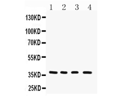 Western blot analysis of MTCO1 using anti-MTCO1 antibody (PA1317).