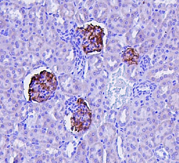 IHC analysis of NPHS2 using anti-NPHS2 antibody (PA1322-1). NPHS2 was detected in paraffin-embedded section of mouse kidney tissues. Heat mediated antigen retrieval was performed in citrate buffer (pH6, epitope retrieval solution) for 20 mins. The tissue section was blocked with 10% goat serum. The tissue section was then incubated with 1μg/ml rabbit anti-NPHS2 Antibody (PA1322-1) overnight at 4°C. Biotinylated goat anti-rabbit IgG was used as secondary antibody and incubated for 30 minutes at 37°C. The tissue section was developed using Strepavidin-Biotin-Complex (SABC)(Catalog # SA1022) with DAB as the chromogen.