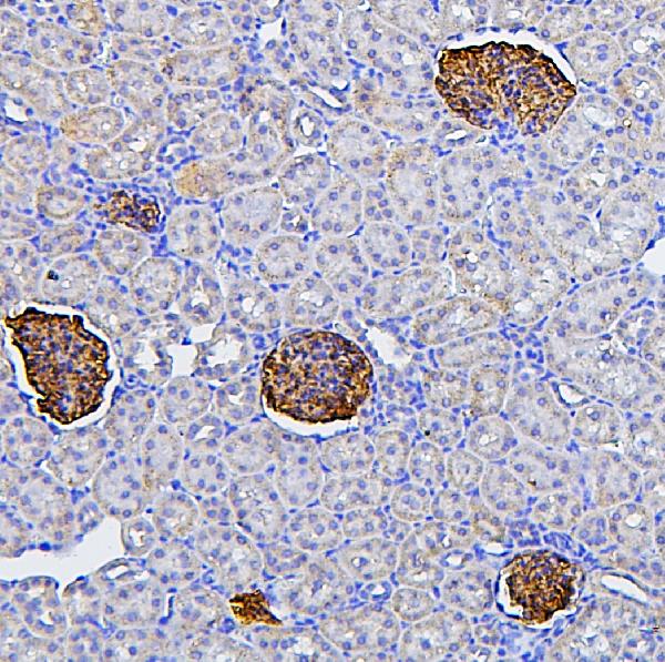 IHC analysis of NPHS2 using anti-NPHS2 antibody (PA1322-1). NPHS2 was detected in paraffin-embedded section of rat kidney tissues. Heat mediated antigen retrieval was performed in citrate buffer (pH6, epitope retrieval solution) for 20 mins. The tissue section was blocked with 10% goat serum. The tissue section was then incubated with 1μg/ml rabbit anti-NPHS2 Antibody (PA1322-1) overnight at 4°C. Biotinylated goat anti-rabbit IgG was used as secondary antibody and incubated for 30 minutes at 37°C. The tissue section was developed using Strepavidin-Biotin-Complex (SABC)(Catalog # SA1022) with DAB as the chromogen.