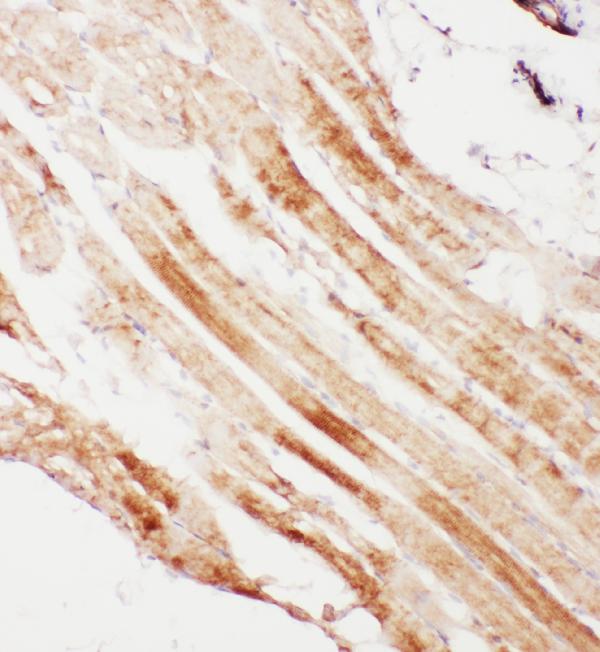 IHC analysis of Calpain 1 using anti-Calpain 1 antibody (PA1364). Calpain 1 was detected in frozen section of rat cardiac muscle tissue. The tissue section was blocked with 10% goat serum. The tissue section was then incubated with 1μg/ml rabbit anti-Calpain 1 Antibody (PA1364) overnight at 4°C. Biotinylated goat anti-rabbit IgG was used as secondary antibody and incubated for 30 minutes at 37°C. The tissue section was developed using Strepavidin-Biotin-Complex (SABC)(Catalog # SA1022) with DAB as the chromogen.