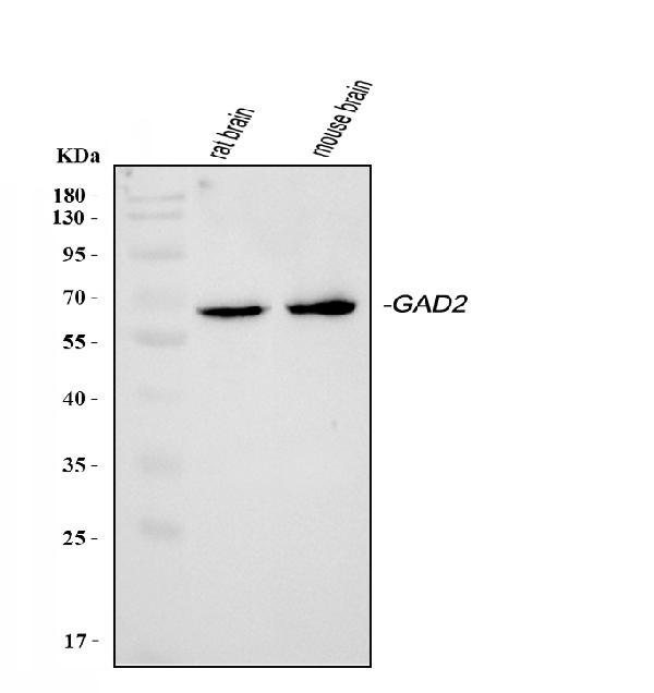 Western blot analysis of GAD65/GAD2 using anti-GAD65/GAD2 antibody (PA1403).