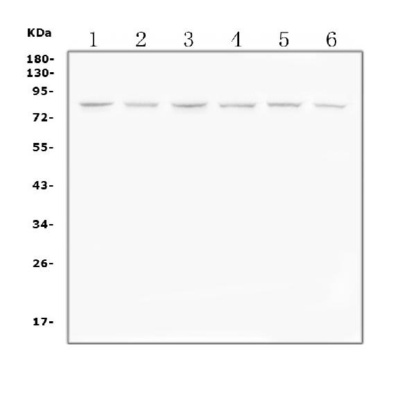 Western blot analysis of PI 3 Kinase p85 alpha using anti-PI 3 Kinase p85 alpha antibody (PA1410). Electrophoresis was performed on a 5-20% SDS-PAGE gel at 70V (Stacking gel) / 90V (Resolving gel) for 2-3 hours. The sample well of each lane was loaded with 50ug of sample under reducing conditions. Lane 1: rat brain tissue lysates Lane 2: rat lung tissue lysates Lane 3: rat PC-12 whole cell lysates Lane 4: mouse brain tissue lysates Lane 5: mouse HEPA1-6 whole cell lysates Lane 6: mouse RAW246.7 whole cell lysates After Electrophoresis, proteins were transferred to a Nitrocellulose membrane at 150mA for 50-90 minutes. Blocked the membrane with 5% Non-fat Milk/ TBS for 1.5 hour at RT. The membrane was incubated with rabbit anti-PI 3 Kinase p85 alpha antigen affinity purified polyclonal antibody (Catalog # PA1410) at 0.5 μg/mL overnight at 4°C, then washed with TBS-0.1%Tween 3 times with 5 minutes each and probed with a goat anti-rabbit IgG-HRP secondary antibody at a dilution of 1:10000 for 1.5 hour at RT. The signal is developed using an Enhanced Chemiluminescent detection (ECL) kit (Catalog # EK1002) with Tanon 5200 system. A specific band was detected for PI 3 Kinase p85 alpha at approximately 85KD. The expected band size for PI 3 Kinase p85 alpha is at 85KD.