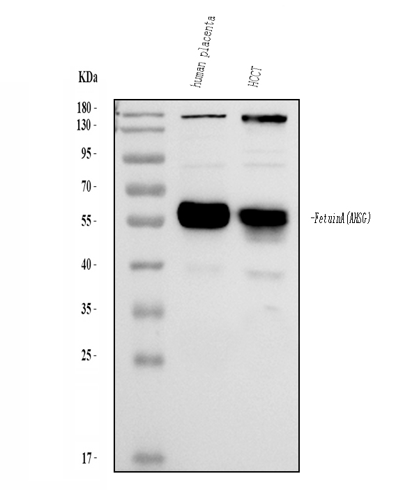 Western blot analysis of Fetuin A using anti-Fetuin A antibody (PA1421).