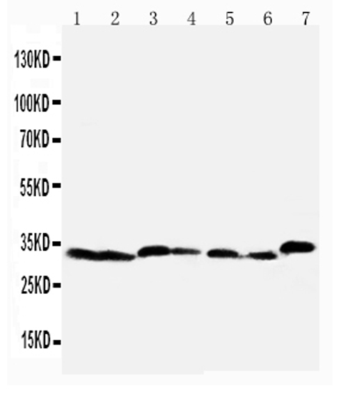 Anti-Caspase-6(P18) antibody, PA1441-1, Western blotting Lane 1: Rat Liver Tissue Lysate Lane 2: Rat Kidney Tissue Lysate Lane 3: Rat Testis Tissue Lysate Lane 4: NRK Cell Lysate Lane 5: Mouse Liver Tissue Lysate Lane 6: Mouse Kidney Tissue Lysate Lane 7: Mouse Testis Tissue Lysate