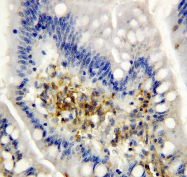 IHC analysis of AIMP2 using anti-AIMP2 antibody (PA1481). AIMP2 was detected in paraffin-embedded section of rat intestine tissues. Heat mediated antigen retrieval was performed in citrate buffer (pH6, epitope retrieval solution) for 20 mins. The tissue section was blocked with 10% goat serum. The tissue section was then incubated with 1μg/ml rabbit anti-AIMP2 Antibody (PA1481) overnight at 4°C. Biotinylated goat anti-rabbit IgG was used as secondary antibody and incubated for 30 minutes at 37°C. The tissue section was developed using Strepavidin-Biotin-Complex (SABC)(Catalog # SA1022) with DAB as the chromogen.