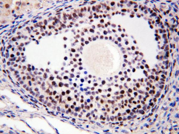 IHC analysis of MTA1 using anti-MTA1 antibody (PA1483). MTA1 was detected in paraffin-embedded section of rat ovary tissues. Heat mediated antigen retrieval was performed in citrate buffer (pH6, epitope retrieval solution) for 20 mins. The tissue section was blocked with 10% goat serum. The tissue section was then incubated with 1μg/ml rabbit anti-MTA1Antibody (PA1483) overnight at 4°C. Biotinylated goat anti-rabbit IgG was used as secondary antibody and incubated for 30 minutes at 37°C. The tissue section was developed using Strepavidin-Biotin-Complex (SABC)(Catalog # SA1022) with DAB as the chromogen.