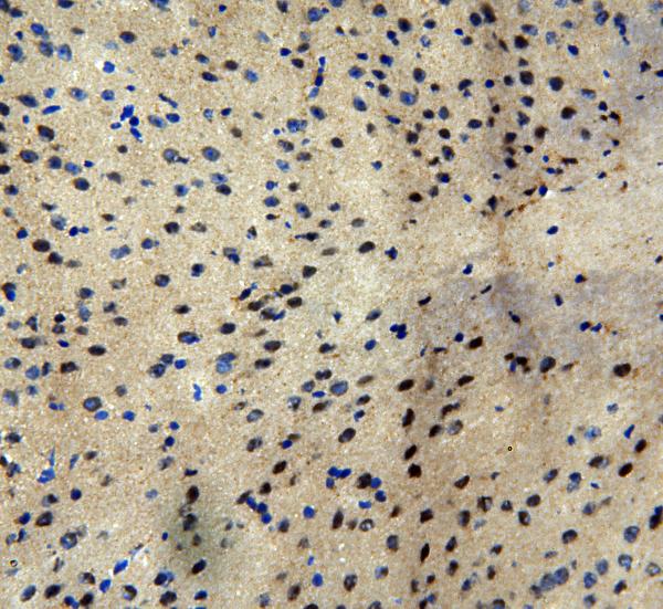 IHC analysis of MTA1 using anti-MTA1 antibody (PA1483). MTA1 was detected in frozen section of mouse brain tissues. The tissue section was blocked with 10% goat serum. The tissue section was then incubated with 1μg/ml rabbit anti-MTA1 Antibody (PA1483) overnight at 4°C. Biotinylated goat anti-rabbit IgG was used as secondary antibody and incubated for 30 minutes at 37°C. The tissue section was developed using Strepavidin-Biotin-Complex (SABC)(Catalog # SA1022) with DAB as the chromogen.