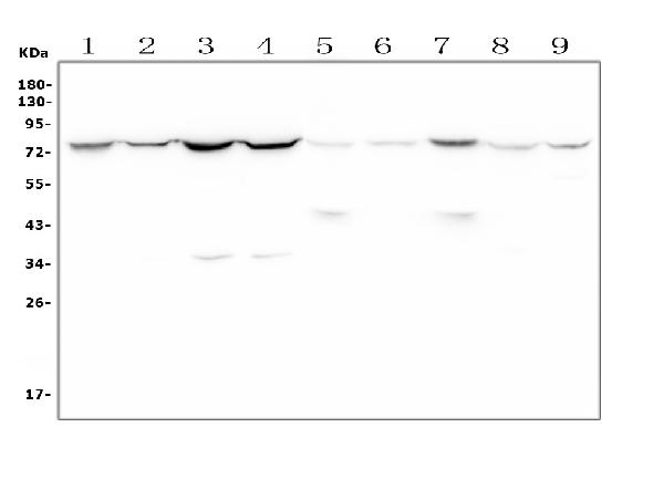 Western blot analysis of MEKK2 using anti-MEKK2 antibody (PA1499). Electrophoresis was performed on a 5-20% SDS-PAGE gel at 70V (Stacking gel) / 90V (Resolving gel) for 2-3 hours. The sample well of each lane was loaded with 50ug of sample under reducing conditions. Lane 1: rat kidney tissue lysates Lane 2: rat brain tissue lysates Lane 3: rat heart tissue lysates Lane 4: rat C6 whole cell lysates Lane 5: mouse kidney tissue lysates Lane 6: mouse brain tissue lysates Lane 7: mouse heart tissue lysates Lane 8: mouse Neuro-2a whole cell lysates Lane 9: mouse NIH/3T3 whole cell lysates After Electrophoresis, proteins were transferred to a Nitrocellulose membrane at 150mA for 50-90 minutes. Blocked the membrane with 5% Non-fat Milk/ TBS for 1.5 hour at RT. The membrane was incubated with rabbit anti-MEKK2 antigen affinity purified polyclonal antibody (Catalog # PA1499) at 0.5 μg/mL overnight at 4°C, then washed with TBS-0.1%Tween 3 times with 5 minutes each and probed with a goat anti-rabbit IgG-HRP secondary antibody at a dilution of 1:10000 for 1.5 hour at RT. The signal is developed using an Enhanced Chemiluminescent detection (ECL) kit (Catalog # EK1002) with Tanon 5200 system. A specific band was detected for MEKK2 at approximately 78KD. The expected band size for MEKK2 is at 70KD.