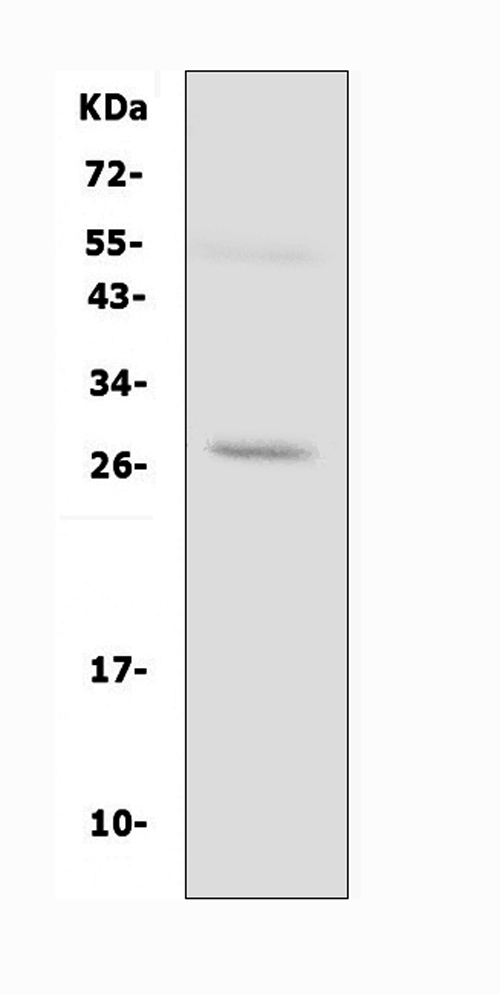 Western blot analysis of AQP8 using anti-AQP8 antibody (PA1511). Electrophoresis was performed on a 5-20% SDS-PAGE gel at 70V (Stacking gel) / 90V (Resolving gel) for 2-3 hours. The sample well of each lane was loaded with 50ug of sample under reducing conditions. Lane 1: human PC-3 whole cell lysates. After Electrophoresis, proteins were transferred to a Nitrocellulose membrane at 150mA for 50-90 minutes. Blocked the membrane with 5% Non-fat Milk/ TBS for 1.5 hour at RT. The membrane was incubated with rabbit anti-AQP8 antigen affinity purified polyclonal antibody (Catalog # PA1511) at 0.5 μg/mL overnight at 4°C, then washed with TBS-0.1%Tween 3 times with 5 minutes each and probed with a goat anti-rabbit IgG-HRP secondary antibody at a dilution of 1:10000 for 1.5 hour at RT. The signal is developed using an Enhanced Chemiluminescent detection (ECL) kit (Catalog # EK1002) with Tanon 5200 system. A specific band was detected for AQP8 at approximately 27KD. The expected band size for AQP8 is at 27KD.