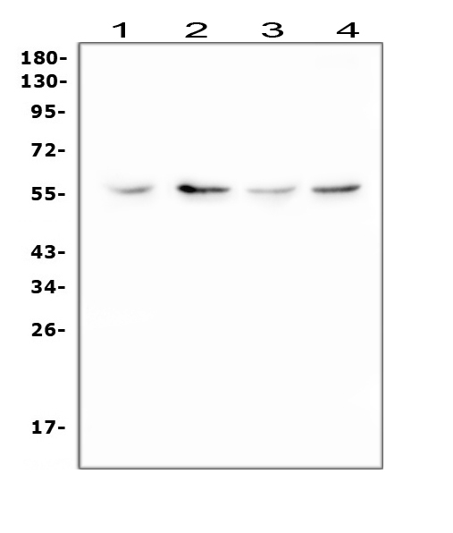 Western blot analysis of XIAP using anti-XIAP antibody (PA1512). Electrophoresis was performed on a 5-20% SDS-PAGE gel at 70V (Stacking gel) / 90V (Resolving gel) for 2-3 hours. The sample well of each lane was loaded with 50ug of sample under reducing conditions. Lane 1: human HepG2 whole cell lysate, Lane 2: human Raji whole cell lysate, Lane 3: rat C6 whole cell lysate, Lane 4: mouse Neuro-2a whole cell lysate. After Electrophoresis, proteins were transferred to a Nitrocellulose membrane at 150mA for 50-90 minutes. Blocked the membrane with 5% Non-fat Milk/ TBS for 1.5 hour at RT. The membrane was incubated with rabbit anti-XIAP antigen affinity purified polyclonal antibody (Catalog # PA1512) at 0.5 μg/mL overnight at 4°C, then washed with TBS-0.1%Tween 3 times with 5 minutes each and probed with a goat anti-rabbit IgG-HRP secondary antibody at a dilution of 1:10000 for 1.5 hour at RT. The signal is developed using an Enhanced Chemiluminescent detection (ECL) kit (Catalog # EK1002) with Tanon 5200 system. A specific band was detected for XIAP at approximately 57KD. The expected band size for XIAP is at 57KD.