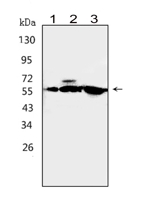 Western blot analysis of CAMKK1 using anti-CAMKK1 antibody (PA1520). Electrophoresis was performed on a 5-20% SDS-PAGE gel at 70V (Stacking gel) / 90V (Resolving gel) for 2-3 hours. The sample well of each lane was loaded with 50ug of sample under reducing conditions. Lane 1: rat brain tissue lysates, Lane 2: mouse brain tissue lysates, Lane 3: human U-87MG whole cell lysates, After Electrophoresis, proteins were transferred to a Nitrocellulose membrane at 150mA for 50-90 minutes. Blocked the membrane with 5% Non-fat Milk/ TBS for 1.5 hour at RT. The membrane was incubated with rabbit anti-CAMKK1 antigen affinity purified polyclonal antibody (Catalog # PA1520) at 0.5 μg/mL overnight at 4°C, then washed with TBS-0.1%Tween 3 times with 5 minutes each and probed with a goat anti-rabbit IgG-HRP secondary antibody at a dilution of 1:10000 for 1.5 hour at RT. The signal is developed using an Enhanced Chemiluminescent detection (ECL) kit (Catalog # EK1002) with Tanon 5200 system. A specific band was detected for CAMKK1 at approximately 56KD. The expected band size for CAMKK1 is at 56KD.