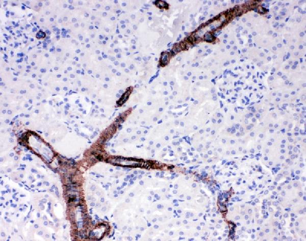 IHC analysis of Canstatin using anti-Canstatin antibody (PA1521). Canstatin was detected in paraffin-embedded section of rat kidney tissues. Heat mediated antigen retrieval was performed in citrate buffer (pH6, epitope retrieval solution) for 20 mins. The tissue section was blocked with 10% goat serum. The tissue section was then incubated with 1μg/ml rabbit anti-Canstatin Antibody (PA1521) overnight at 4°C. Biotinylated goat anti-rabbit IgG was used as secondary antibody and incubated for 30 minutes at 37°C. The tissue section was developed using Strepavidin-Biotin-Complex (SABC)(Catalog # SA1022) with DAB as the chromogen.