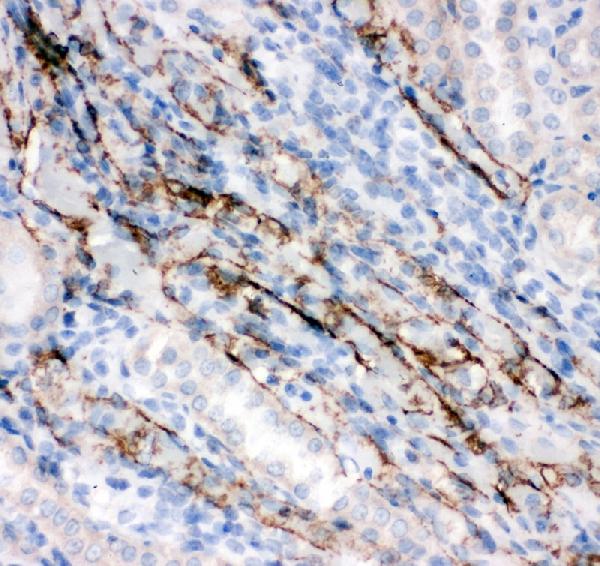 IHC analysis of Canstatin using anti-Canstatin antibody (PA1521). Canstatin was detected in paraffin-embedded section of rat kidney tissues. Heat mediated antigen retrieval was performed in citrate buffer (pH6, epitope retrieval solution) for 20 mins. The tissue section was blocked with 10% goat serum. The tissue section was then incubated with 1μg/ml rabbit anti-Canstatin Antibody (PA1521) overnight at 4°C. Biotinylated goat anti-rabbit IgG was used as secondary antibody and incubated for 30 minutes at 37°C. The tissue section was developed using Strepavidin-Biotin-Complex (SABC)(Catalog # SA1022) with DAB as the chromogen.