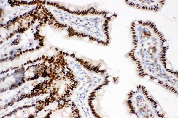 IHC analysis of CTBP2 using anti-CTBP2 antibody (PA1554). CTBP2 was detected in paraffin-embedded section of rat intestine tissues. Heat mediated antigen retrieval was performed in citrate buffer (pH6, epitope retrieval solution) for 20 mins. The tissue section was blocked with 10% goat serum. The tissue section was then incubated with 1μg/ml rabbit anti-CTBP2 Antibody (PA1554) overnight at 4°C. Biotinylated goat anti-rabbit IgG was used as secondary antibody and incubated for 30 minutes at 37°C. The tissue section was developed using Strepavidin-Biotin-Complex (SABC)(Catalog # SA1022) with DAB as the chromogen.