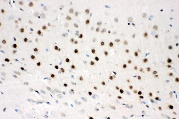 IHC analysis of CTBP2 using anti-CTBP2 antibody (PA1554). CTBP2 was detected in paraffin-embedded section of rat brain tissues. Heat mediated antigen retrieval was performed in citrate buffer (pH6, epitope retrieval solution) for 20 mins. The tissue section was blocked with 10% goat serum. The tissue section was then incubated with 1μg/ml rabbit anti-CTBP2 Antibody (PA1554) overnight at 4°C. Biotinylated goat anti-rabbit IgG was used as secondary antibody and incubated for 30 minutes at 37°C. The tissue section was developed using Strepavidin-Biotin-Complex (SABC)(Catalog # SA1022) with DAB as the chromogen.