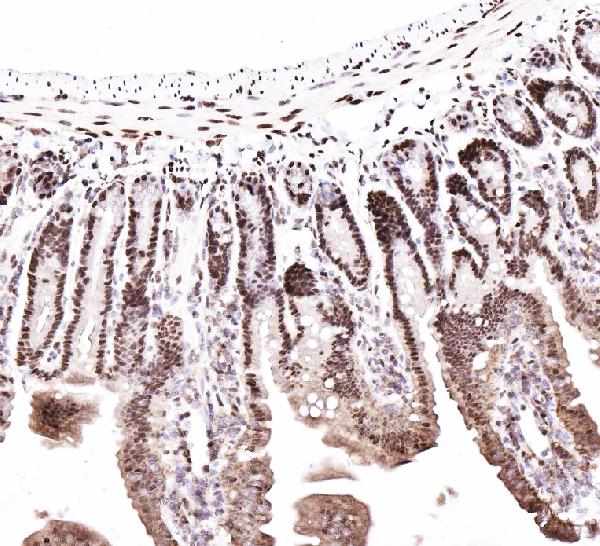 IHC analysis of CTBP2 using anti-CTBP2 antibody (PA1554). CTBP2 was detected in paraffin-embedded section of mouse intestine tissues. Heat mediated antigen retrieval was performed in citrate buffer (pH6, epitope retrieval solution) for 20 mins. The tissue section was blocked with 10% goat serum. The tissue section was then incubated with 1μg/ml rabbit anti-CTBP2 Antibody (PA1554) overnight at 4°C. Biotinylated goat anti-rabbit IgG was used as secondary antibody and incubated for 30 minutes at 37°C. The tissue section was developed using Strepavidin-Biotin-Complex (SABC)(Catalog # SA1022) with DAB as the chromogen.