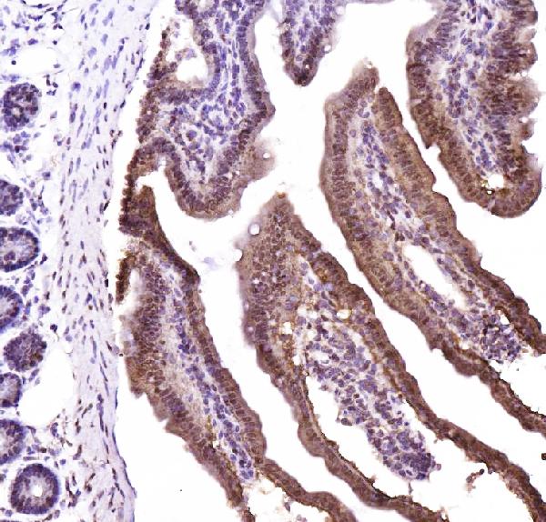 IHC analysis of CTBP2 using anti-CTBP2 antibody (PA1554). CTBP2 was detected in frozen section of mouse intestine tissues. The tissue section was blocked with 10% goat serum. The tissue section was then incubated with 1μg/ml rabbit anti-CTBP2 Antibody (PA1554) overnight at 4°C. Biotinylated goat anti-rabbit IgG was used as secondary antibody and incubated for 30 minutes at 37°C. The tissue section was developed using Strepavidin-Biotin-Complex (SABC)(Catalog # SA1022) with DAB as the chromogen.