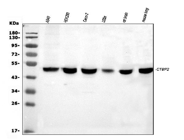 Western blot analysis of CTBP2 using anti-CTBP2 antibody (PA1554).