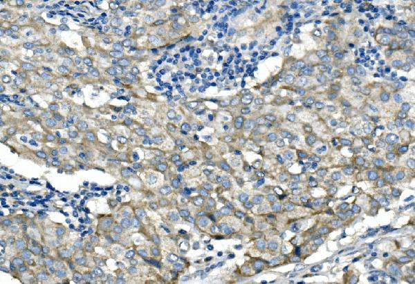 IHC analysis of DSG2 using anti-DSG2 antibody (PA1559).