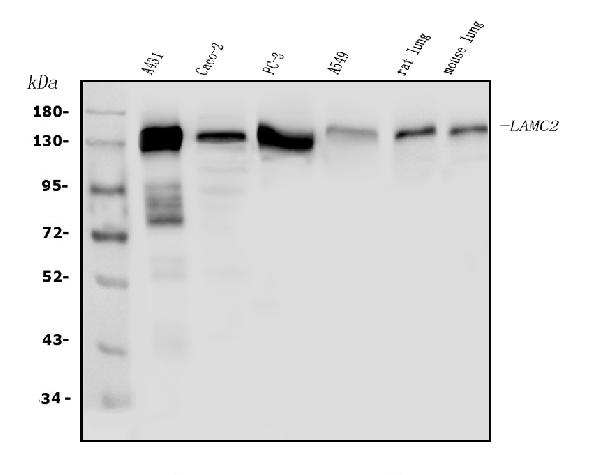 Western blot analysis of LAMC2 using anti-LAMC2 antibody (PA1582).