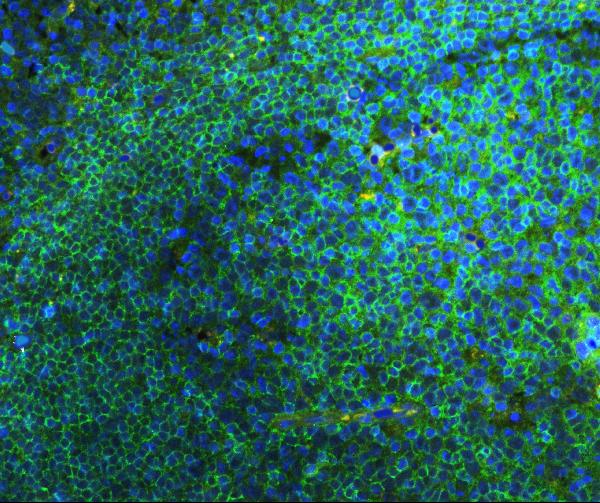 IF analysis of CD45 using anti-CD45 antibody (PA1596) CD45 was detected in paraffin-embedded section of human tonsil tissues. Heat mediated antigen retrieval was performed in citrate buffer (pH6, epitope retrieval solution ) for 20 mins. The tissue section was blocked with 10% goat serum. The tissue section was then incubated with 1μg/mL rabbit anti-CD45 Antibody (PA1596) overnight at 4°C. DyLight®488 Conjugated Goat Anti-Rabbit IgG (BA1127) was used as secondary antibody at 1:100 dilution and incubated for 30 minutes at 37°C. The section was counterstained with DAPI. Visualize using a fluorescence microscope and filter sets appropriate for the label used.