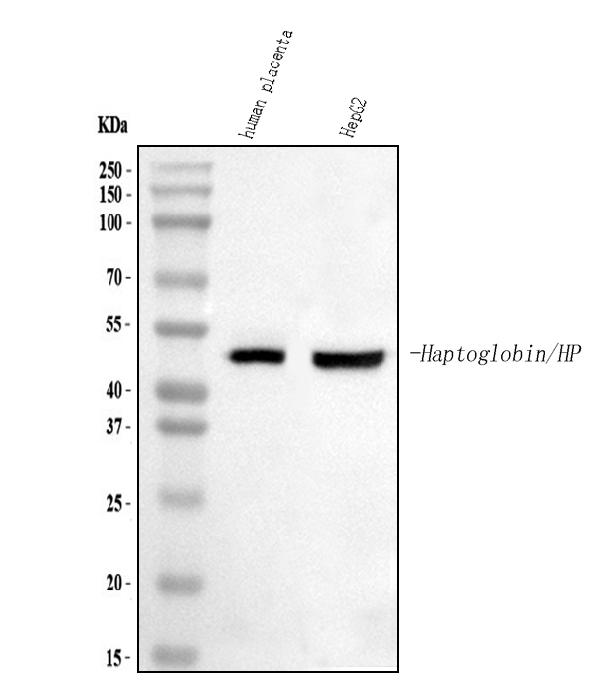 Western blot analysis of Haptoglobin/HP using anti-Haptoglobin/HP antibody (PA1599).