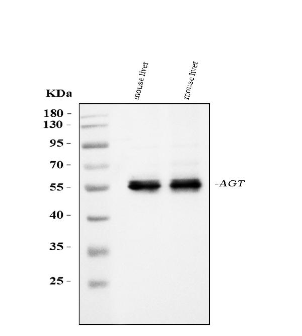 Western blot analysis of Angiotensinogen/AGT using anti-Angiotensinogen/AGT antibody (PA1643).