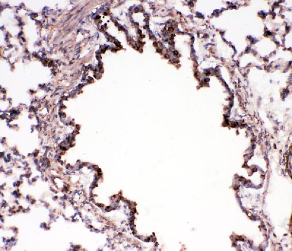 IHC analysis of BUB3 using anti-BUB3 antibody (PA1645). BUB3 was detected in frozen section of rat lung tissues. The tissue section was blocked with 10% goat serum. The tissue section was then incubated with 1μg/ml rabbit anti-BUB3 Antibody (PA1645) overnight at 4°C. Biotinylated goat anti-rabbit IgG was used as secondary antibody and incubated for 30 minutes at 37°C. The tissue section was developed using Strepavidin-Biotin-Complex (SABC)(Catalog # SA1022) with DAB as the chromogen.