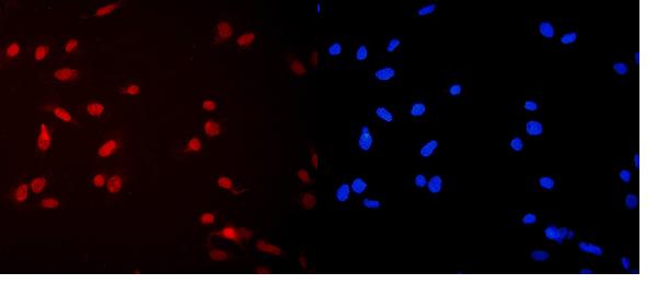 IF analysis of MCM2 using anti-MCM2 antibody (PA1650).