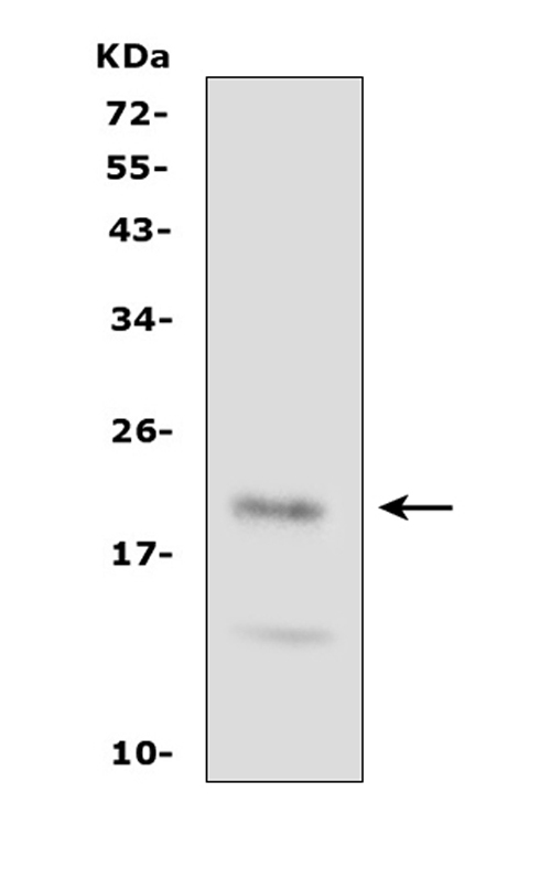 Western blot analysis of FGF21 using anti-FGF21 antibody (PA1673). Electrophoresis was performed on a 5-20% SDS-PAGE gel at 70V (Stacking gel) / 90V (Resolving gel) for 2-3 hours. The sample well of each lane was loaded with 50ug of sample under reducing conditions. Lane 1: rat spleen tissue Lysate. After Electrophoresis, proteins were transferred to a Nitrocellulose membrane at 150mA for 50-90 minutes. Blocked the membrane with 5% Non-fat Milk/ TBS for 1.5 hour at RT. The membrane was incubated with rabbit anti-FGF21 antigen affinity purified polyclonal antibody (Catalog # PA1673) at 0.5 μg/mL overnight at 4°C, then washed with TBS-0.1%Tween 3 times with 5 minutes each and probed with a goat anti-rabbit IgG-HRP secondary antibody at a dilution of 1:10000 for 1.5 hour at RT. The signal is developed using an Enhanced Chemiluminescent detection (ECL) kit (Catalog # EK1002) with Tanon 5200 system. A specific band was detected for FGF21 at approximately 21KD. The expected band size for FGF21 is at 21KD.