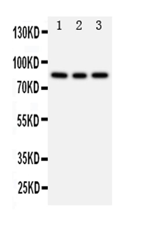 Western blot analysis of PIK3R2 using anti-PIK3R2 antibody (PA1680). Electrophoresis was performed on a 5-20% SDS-PAGE gel at 70V (Stacking gel) / 90V (Resolving gel) for 2-3 hours. The sample well of each lane was loaded with 50ug of sample under reducing conditions. Lane 1: Rat Testis tissue lysates, Lane 2: 293T whole cell lysates, Lane 3: HELA whole cell lysates. After Electrophoresis, proteins were transferred to a Nitrocellulose membrane at 150mA for 50-90 minutes. Blocked the membrane with 5% Non-fat Milk/ TBS for 1.5 hour at RT. The membrane was incubated with rabbit anti-PIK3R2 antigen affinity purified polyclonal antibody (Catalog # PA1680) at 0.5 μg/mL overnight at 4°C, then washed with TBS-0.1%Tween 3 times with 5 minutes each and probed with a goat anti-rabbit IgG-HRP secondary antibody at a dilution of 1:10000 for 1.5 hour at RT. The signal is developed using an Enhanced Chemiluminescent detection (ECL) kit (Catalog # EK1002) with Tanon 5200 system. A specific band was detected for PIK3R2 at approximately 85KD. The expected band size for PIK3R2 is at 85KD.