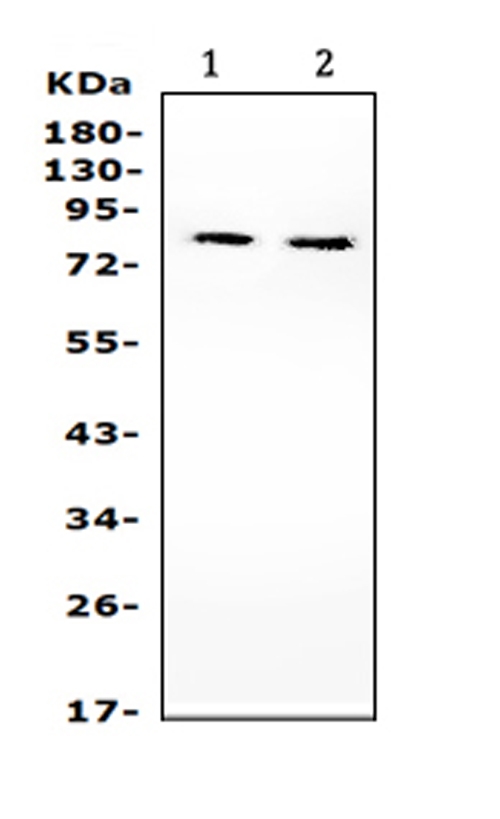 Western blot analysis of PIK3R2 using anti-PIK3R2 antibody (PA1680). Electrophoresis was performed on a 5-20% SDS-PAGE gel at 70V (Stacking gel) / 90V (Resolving gel) for 2-3 hours. The sample well of each lane was loaded with 50ug of sample under reducing conditions. Lane 1: mouse liver tissue lysates, Lane 2: mouse brain tissue lysates. After Electrophoresis, proteins were transferred to a Nitrocellulose membrane at 150mA for 50-90 minutes. Blocked the membrane with 5% Non-fat Milk/ TBS for 1.5 hour at RT. The membrane was incubated with rabbit anti-PIK3R2 antigen affinity purified polyclonal antibody (Catalog # PA1680) at 0.5 μg/mL overnight at 4°C, then washed with TBS-0.1%Tween 3 times with 5 minutes each and probed with a goat anti-rabbit IgG-HRP secondary antibody at a dilution of 1:10000 for 1.5 hour at RT. The signal is developed using an Enhanced Chemiluminescent detection (ECL) kit (Catalog # EK1002) with Tanon 5200 system. A specific band was detected for PIK3R2 at approximately 85KD. The expected band size for PIK3R2 is at 85KD.