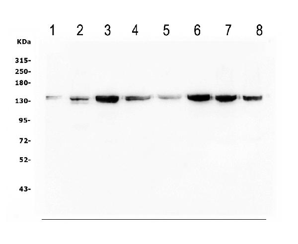 Western blot analysis of PPP1R12A using anti-PPP1R12A antibody (PA1681). Electrophoresis was performed on a 5-20% SDS-PAGE gel at 70V (Stacking gel) / 90V (Resolving gel) for 2-3 hours. The sample well of each lane was loaded with 50ug of sample under reducing conditions. Lane 1: human Hela whole cell lysates, Lane 2: human Jurka7 whole cell lysates, Lane 3: human HEK293 whole cell lysates, Lane 4: monkey COS-7 whole cell lysates, Lane 5: human Raji whole cell lysates, Lane 6: human K562 whole cell lysates, Lane 7: human Caco-2 whole cell lysates, Lane 8: human HepG2 whole cell lysates, After Electrophoresis, proteins were transferred to a Nitrocellulose membrane at 150mA for 50-90 minutes. Blocked the membrane with 5% Non-fat Milk/ TBS for 1.5 hour at RT. The membrane was incubated with rabbit anti-PPP1R12A antigen affinity purified polyclonal antibody (Catalog # PA1681) at 0.5 μg/mL overnight at 4°C, then washed with TBS-0.1%Tween 3 times with 5 minutes each and probed with a goat anti-rabbit IgG-HRP secondary antibody at a dilution of 1:10000 for 1.5 hour at RT. The signal is developed using an Enhanced Chemiluminescent detection (ECL) kit (Catalog # EK1002) with Tanon 5200 system. A specific band was detected for PPP1R12A at approximately 140KD. The expected band size for PPP1R12A is at 115KD.