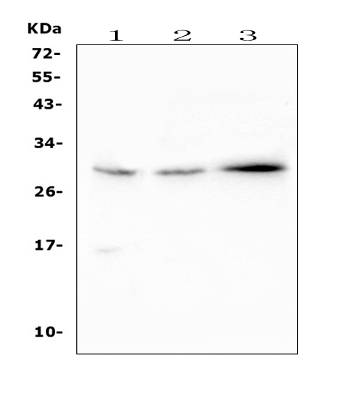 Western blot analysis of SOCS3 using anti-SOCS3 antibody (PA1707). Electrophoresis was performed on a 5-20% SDS-PAGE gel at 70V (Stacking gel) / 90V (Resolving gel) for 2-3 hours. The sample well of each lane was loaded with 50ug of sample under reducing conditions. Lane 1: human Hela whole cell lysates, Lane 2: human A549 whole cell lysates, Lane 3: human A431 whole cell lysates. After Electrophoresis, proteins were transferred to a Nitrocellulose membrane at 150mA for 50-90 minutes. Blocked the membrane with 5% Non-fat Milk/ TBS for 1.5 hour at RT. The membrane was incubated with rabbit anti-SOCS3 antigen affinity purified polyclonal antibody (Catalog # PA1707) at 0.5 μg/mL overnight at 4°C, then washed with TBS-0.1%Tween 3 times with 5 minutes each and probed with a goat anti-rabbit IgG-HRP secondary antibody at a dilution of 1:10000 for 1.5 hour at RT. The signal is developed using an Enhanced Chemiluminescent detection (ECL) kit (Catalog # EK1002) with Tanon 5200 system. A specific band was detected for SOCS3 at approximately 30KD. The expected band size for SOCS3 is at 25KD.