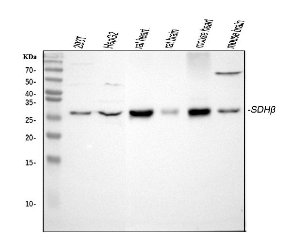 Western blot analysis of SDHB using anti-SDHB antibody (PA1718).