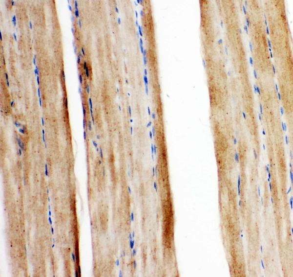 IHC analysis of GLUT5 using anti-GLUT5 antibody (PA1737). GLUT5 was detected in paraffin-embedded section of mouse ggj3249 tissues. Heat mediated antigen retrieval was performed in citrate buffer (pH6, epitope retrieval solution) for 20 mins. The tissue section was blocked with 10% goat serum. The tissue section was then incubated with 1μg/ml rabbit anti-GLUT5 Antibody (PA1737) overnight at 4°C. Biotinylated goat anti-rabbit IgG was used as secondary antibody and incubated for 30 minutes at 37°C. The tissue section was developed using Strepavidin-Biotin-Complex (SABC)(Catalog # SA1022) with DAB as the chromogen.