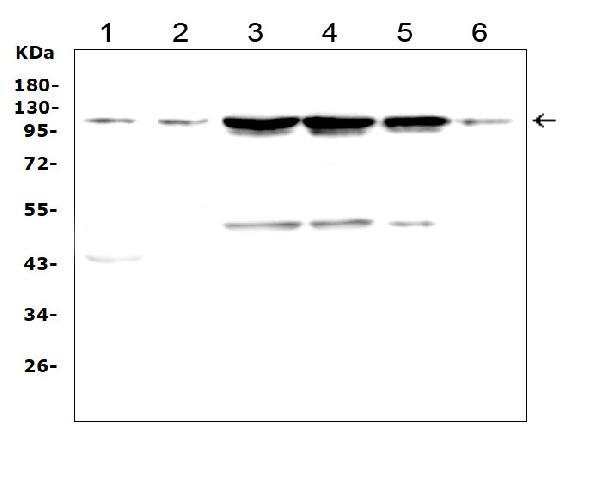 Western blot analysis of TRPC3 using anti-TRPC3 antibody (PA1753). Electrophoresis was performed on a 5-20% SDS-PAGE gel at 70V (Stacking gel) / 90V (Resolving gel) for 2-3 hours. The sample well of each lane was loaded with 50ug of sample under reducing conditions. Lane 1: rat brain tissue lysates, Lane 2: mouse brain tissue lysates, Lane 3: human Hela whole cell lysates, Lane 4: human 22RV1 whole cell lysates, Lane 5: human U-87MG whole cell lysates, Lane 6: mouse Neuro-2a whole cell lysates, After Electrophoresis, proteins were transferred to a Nitrocellulose membrane at 150mA for 50-90 minutes. Blocked the membrane with 5% Non-fat Milk/ TBS for 1.5 hour at RT. The membrane was incubated with rabbit anti-TRPC3 antigen affinity purified polyclonal antibody (Catalog # PA1753) at 0.5 μg/mL overnight at 4°C, then washed with TBS-0.1%Tween 3 times with 5 minutes each and probed with a goat anti-rabbit IgG-HRP secondary antibody at a dilution of 1:10000 for 1.5 hour at RT. The signal is developed using an Enhanced Chemiluminescent detection (ECL) kit (Catalog # EK1002) with Tanon 5200 system. A specific band was detected for TRPC3 at approximately 110KD. The expected band size for TRPC3 is at 93KD.