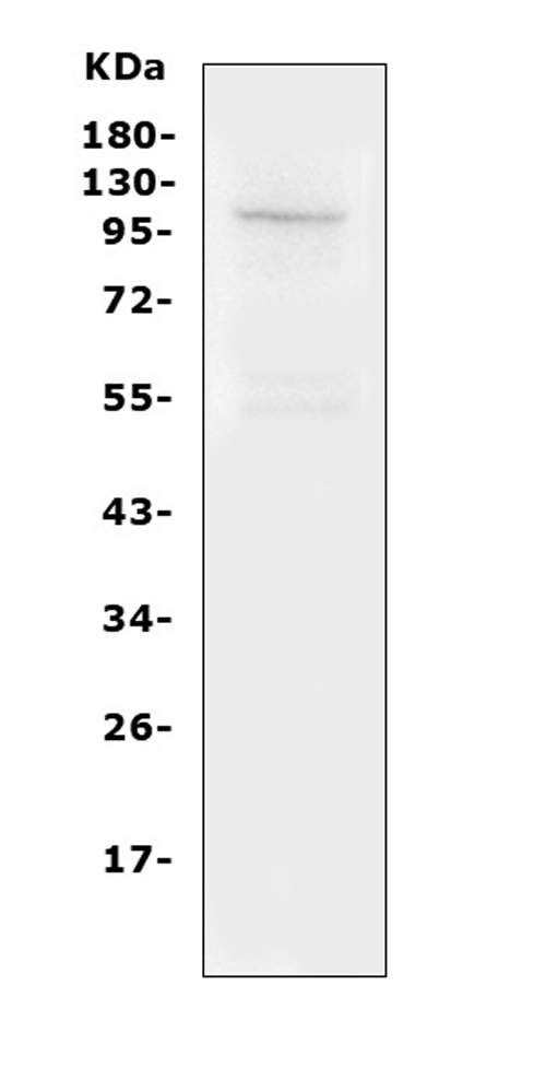 Western blot analysis of TRPC6 using anti-TRPC6 antibody (PA1754). Electrophoresis was performed on a 5-20% SDS-PAGE gel at 70V (Stacking gel) / 90V (Resolving gel) for 2-3 hours. The sample well of each lane was loaded with 50ug of sample under reducing conditions. Lane 1: mouse lung Tissue Lysate After Electrophoresis, proteins were transferred to a Nitrocellulose membrane at 150mA for 50-90 minutes. Blocked the membrane with 5% Non-fat Milk/ TBS for 1.5 hour at RT. The membrane was incubated with rabbit anti-TRPC6 antigen affinity purified polyclonal antibody (Catalog # PA1754) at 0.5 μg/mL overnight at 4°C, then washed with TBS-0.1%Tween 3 times with 5 minutes each and probed with a goat anti-rabbit IgG-HRP secondary antibody at a dilution of 1:10000 for 1.5 hour at RT. The signal is developed using an Enhanced Chemiluminescent detection (ECL) kit (Catalog # EK1002) with Tanon 5200 system. A specific band was detected for TRPC6 at approximately 106KD. The expected band size for TRPC6 is at 106KD.