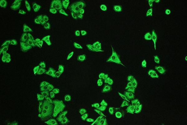 IF analysis of DCI using anti-DCI antibody (PA1763). DCI was detected in immunocytochemical section of A549 cell. Enzyme antigen retrieval was performed using IHC enzyme antigen retrieval reagent (AR0022) for 15 mins. The cells were blocked with 10% goat serum. And then incubated with 2μg/mL rabbit anti-DCI Antibody (PA1763) overnight at 4°C. DyLight®488 Conjugated Goat Anti-Rabbit IgG (BA1127) was used as secondary antibody at 1:100 dilution and incubated for 30 minutes at 37°C. Visualize using a fluorescence microscope and filter sets appropriate for the label used.