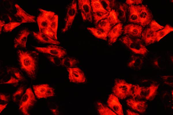 IF analysis of DCI using anti-DCI antibody (PA1763). DCI was detected in immunocytochemical section of A549 cell. Enzyme antigen retrieval was performed using IHC enzyme antigen retrieval reagent (AR0022) for 15 mins. The cells were blocked with 10% goat serum. And then incubated with 2μg/mL rabbit anti-DCI Antibody (PA1763) overnight at 4°C. Cy3 Conjugated Goat Anti-Rabbit IgG (BA1032) was used as secondary antibody at 1:100 dilution and incubated for 30 minutes at 37°C. Visualize using a fluorescence microscope and filter sets appropriate for the label used.