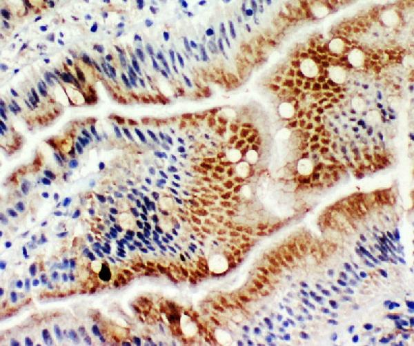 IHC analysis of MCM6 using anti-MCM6 antibody (PA1769). MCM6 was detected in frozen section of rat intestine tissues. The tissue section was blocked with 10% goat serum. The tissue section was then incubated with 1μg/ml rabbit anti-MCM6 Antibody (PA1769) overnight at 4°C. Biotinylated goat anti-rabbit IgG was used as secondary antibody and incubated for 30 minutes at 37°C. The tissue section was developed using Strepavidin-Biotin-Complex (SABC)(Catalog # SA1022) with DAB as the chromogen.