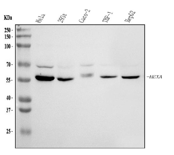 Western blot analysis of HEXA using anti-HEXA antibody (PA1787-2).