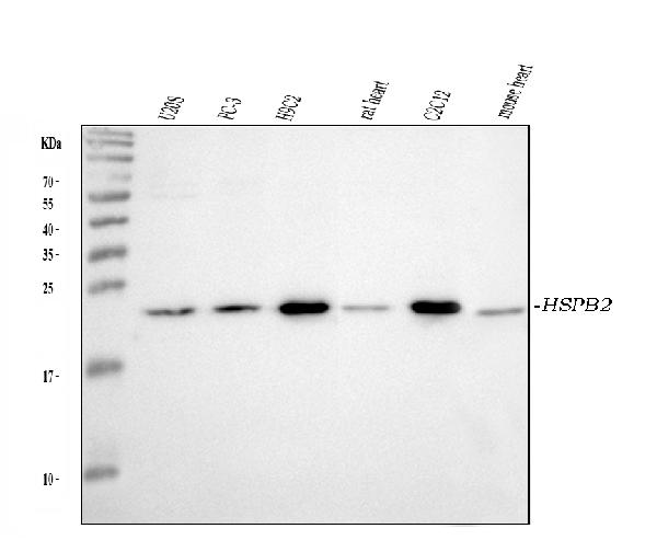 Western blot analysis of HSPB2 using anti-HSPB2 antibody (PA1802).